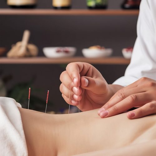 acupuncture